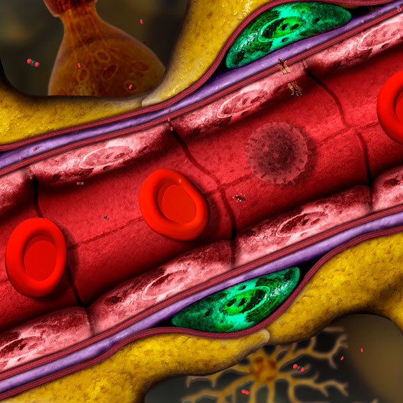 גלי הקול שיכניסו תרופות למוח