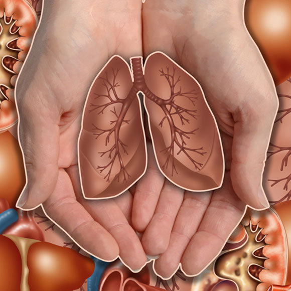 תיקון ריאות להשתלה בעזרת חזיר