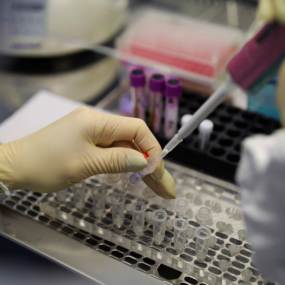 מגפת הקורונה: בדרך לבדיקות מהירות וזולות?