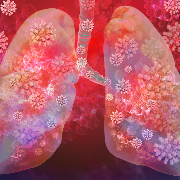 קורונה: האם מנשימים פחות חולים?