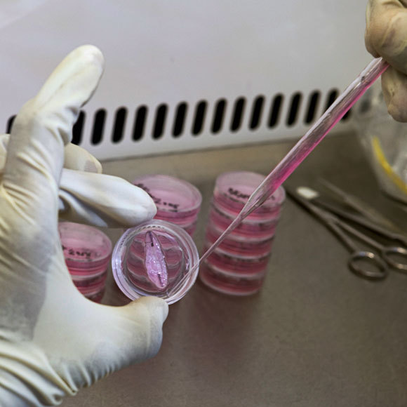 ספיינובוט: חצי חוט שדרה, חצי רובוט