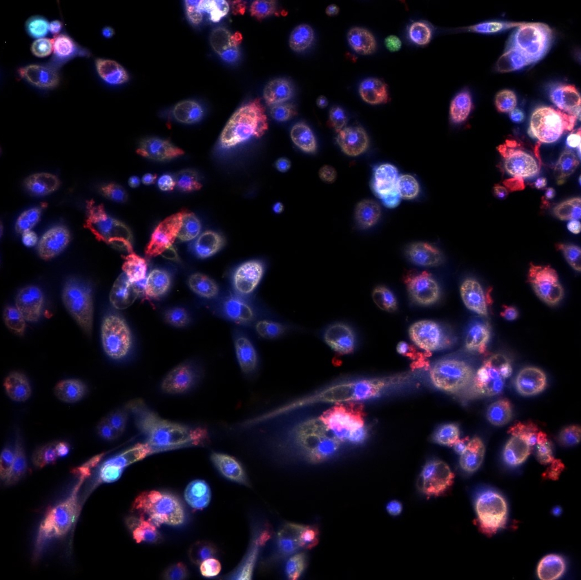 האם השומן של הקורונה יעצור אותה?