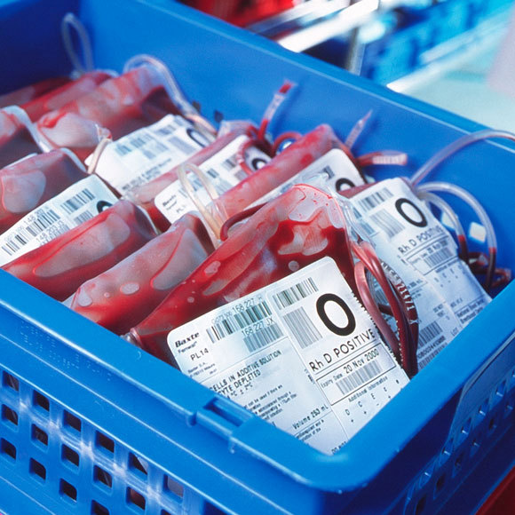 דם, יזע ודמעות: ועכשיו גם אולטרסאונד וסוכר