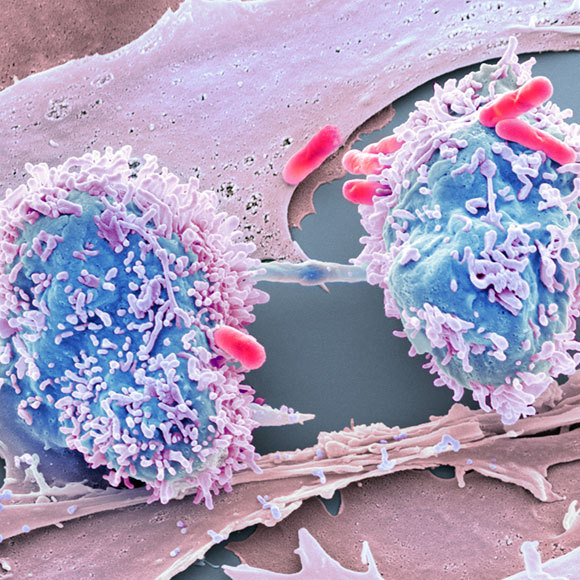 כל גידול והחיידקים שלו