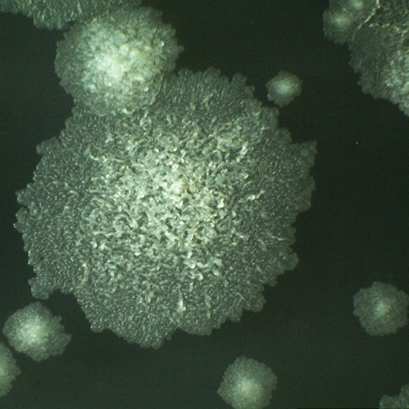 הסכנה החדשה: החיידק הטורף מאוסטרליה