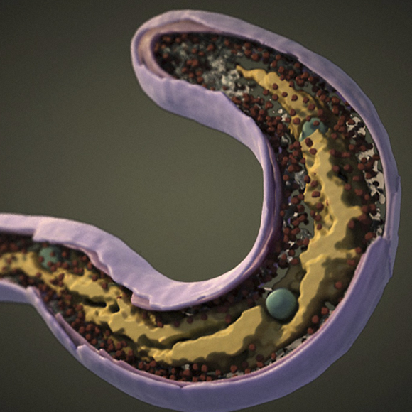 מפתח הדפנות של החיידקים טורפי החיידקים