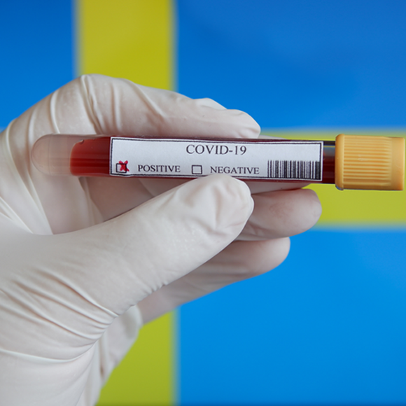 קורונה: האם “המודל השבדי” פועל?