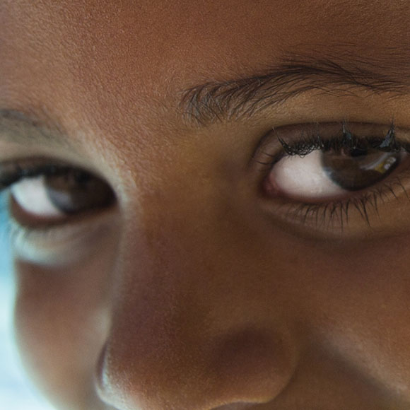 עין תחת עין בריפוי גני