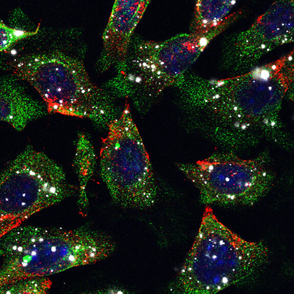 ננו-חלקיקים לקיצור הטיפול בסרטן