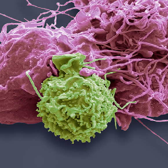 תאי ההרג שמרדימים את הסרטן