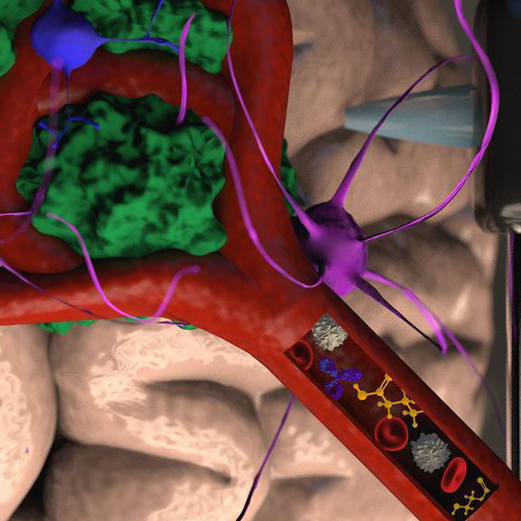 הדפסת גידולים נגד סרטן