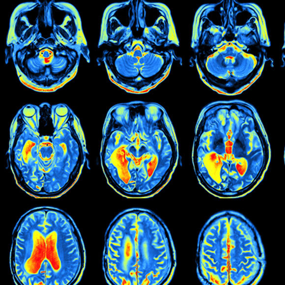 رؤية المخفيّ من العين