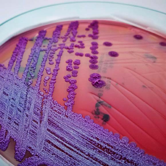 הניחוח הקטלני של התכשיר הארומתרפי