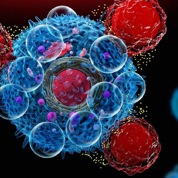 התקלה שמאיימת על הטיפול החדשני בסרטן