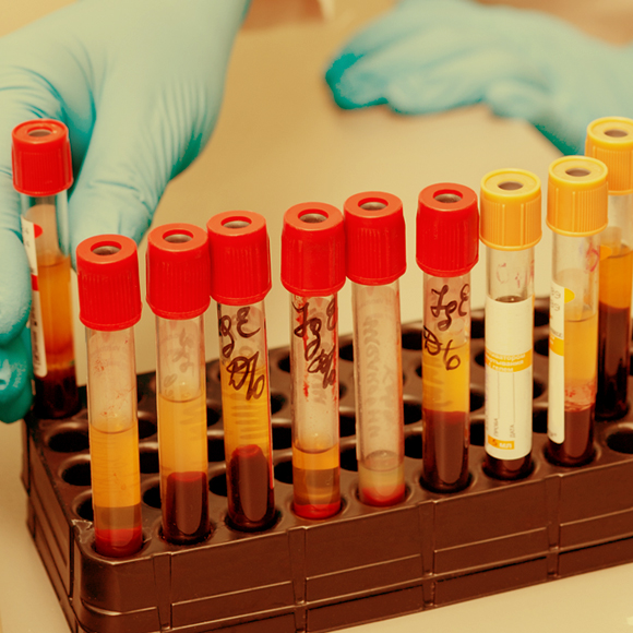 Why Is Blood Type O the Most Common?