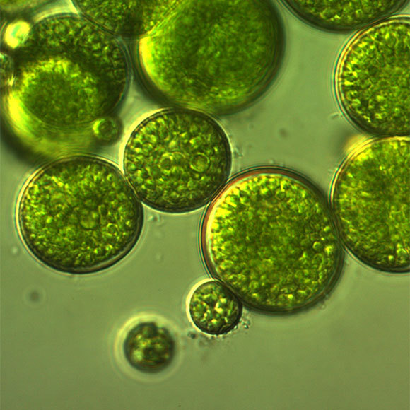 חבישה מאצות