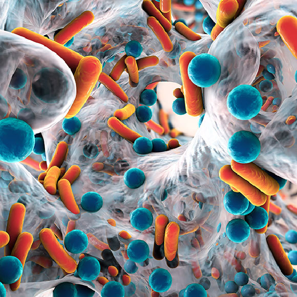 המגפה הנסתרת שהבאנו על עצמנו