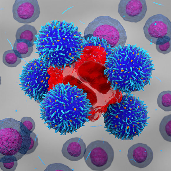 הטיפול הניסיוני בסרטן ממשיך לעבוד גם אחרי עשור