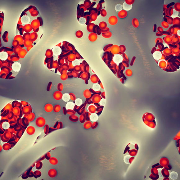 קול קורא לעצמות