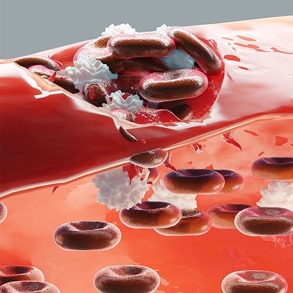 לתקן את הגֵן, לעצור את הדימום