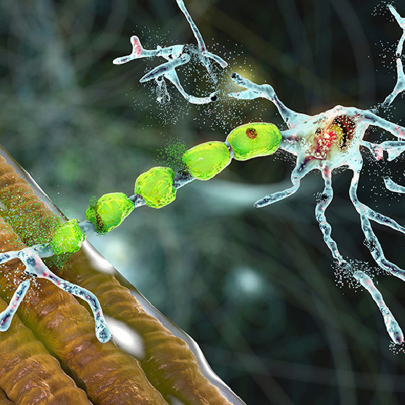 الطفرة التي تُبطئ مرض ALS