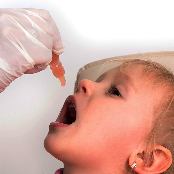 حالة أولى لإصابة بشلل الأطفال منذ أكثر من ثلاثين عامًا