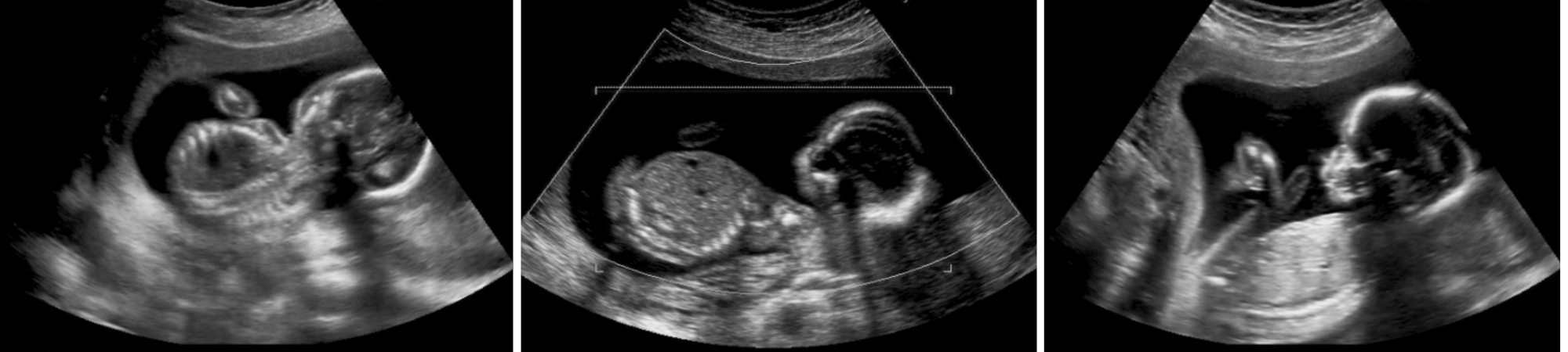 הרופא שראה את הנולד