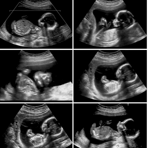 הרופא שראה את הנולד