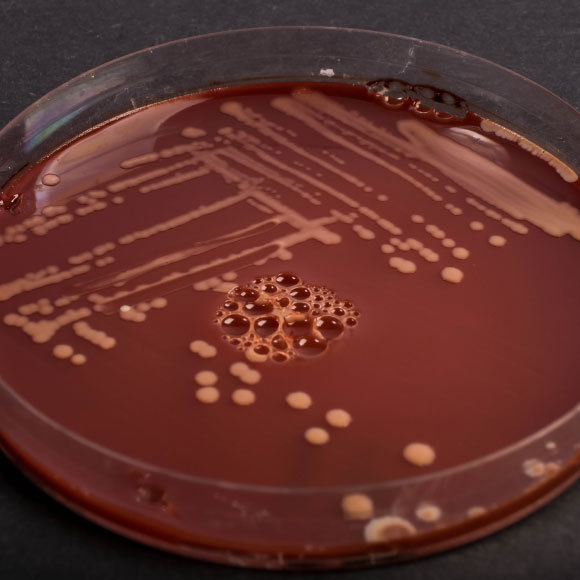 מה הקשר בין שוקולד וסלמונלה?