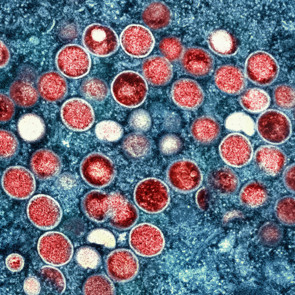 On Pride, Prejudice and Monkeypox