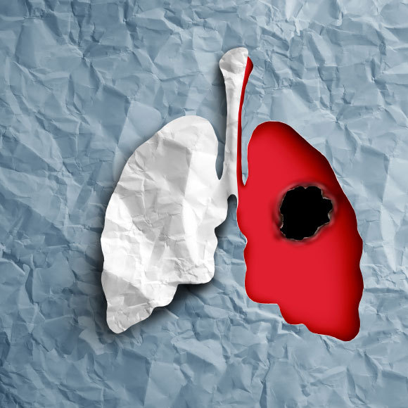 הסרטן הקטלני ביותר