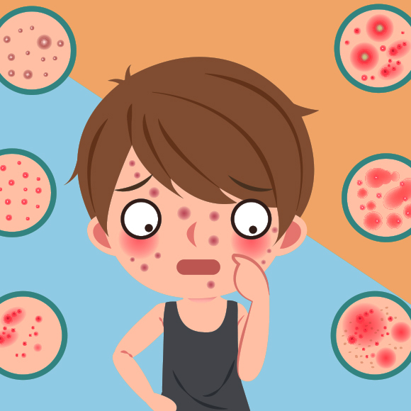 למה נוצרים “פצעי בגרות”?