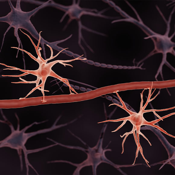 לפתוח את הדרך לתוך המוח