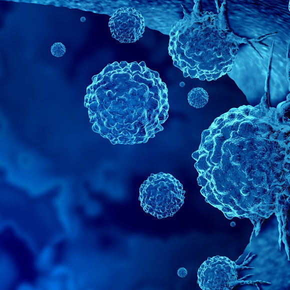 האישה ששרדה 12 גידולים