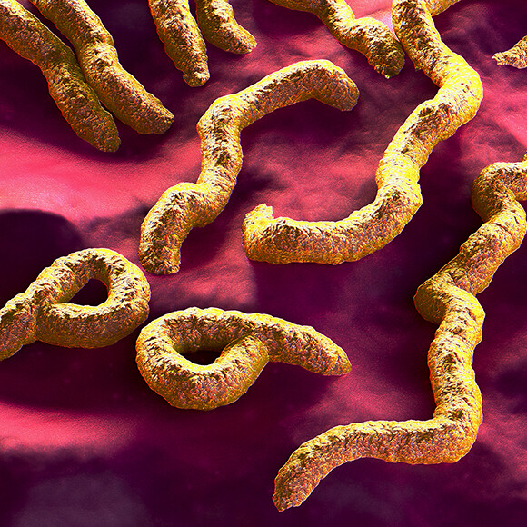 מחלות ללא גבולות: מרבורג במערב אפריקה