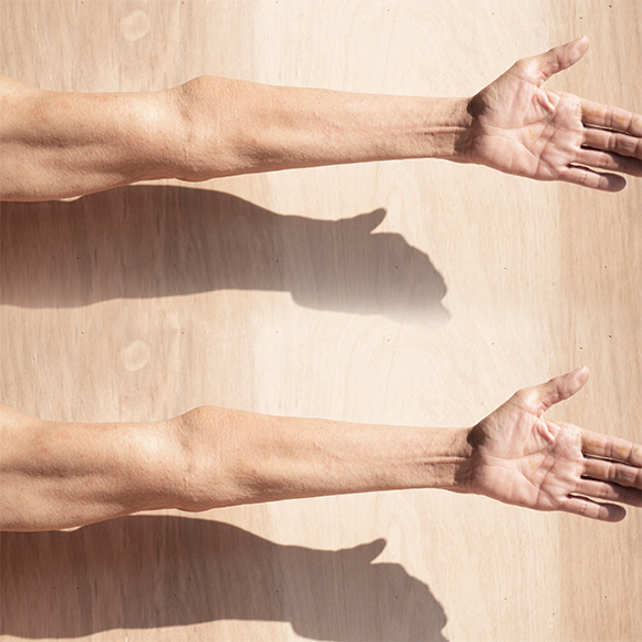 השרירים נחלשים – בגלל השומנים