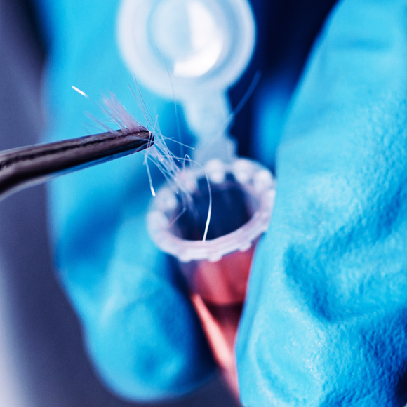 التشخيص الجنائيّ بواسطة الـ DNA من الشّعر