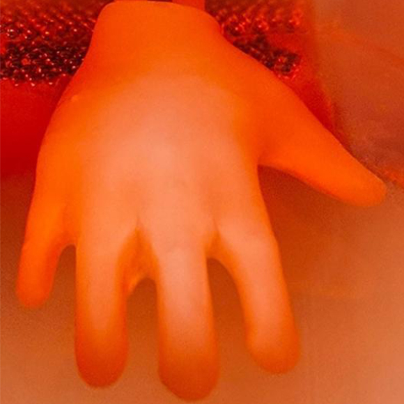 כפפה להשתלה מעור אדם