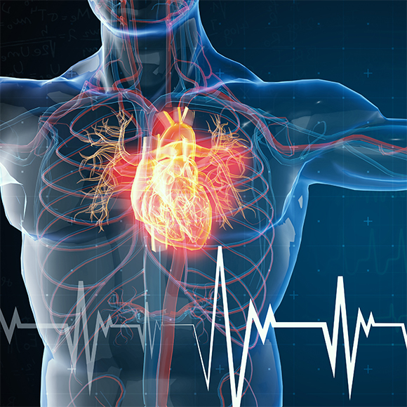 ללבוש את האולטרסאונד