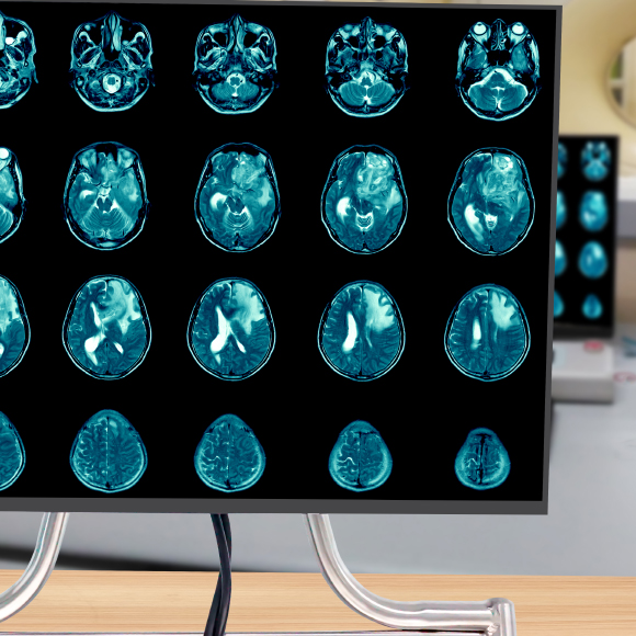 ג’ל נגד סרטן