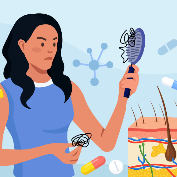 הצלחה לטיפול חדש במחלה שגורמת להתקרחות