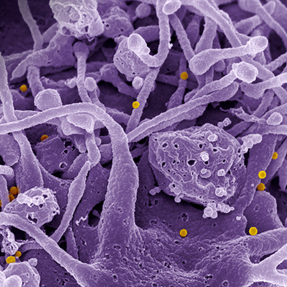 האקלים והקדחת הדימומית: מחלות ללא גבולות