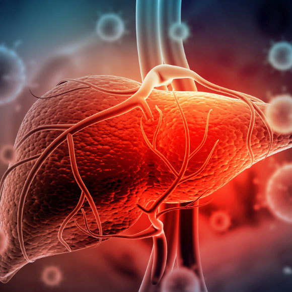 When the Liver Goes Viral – Exploring Viral Hepatitis