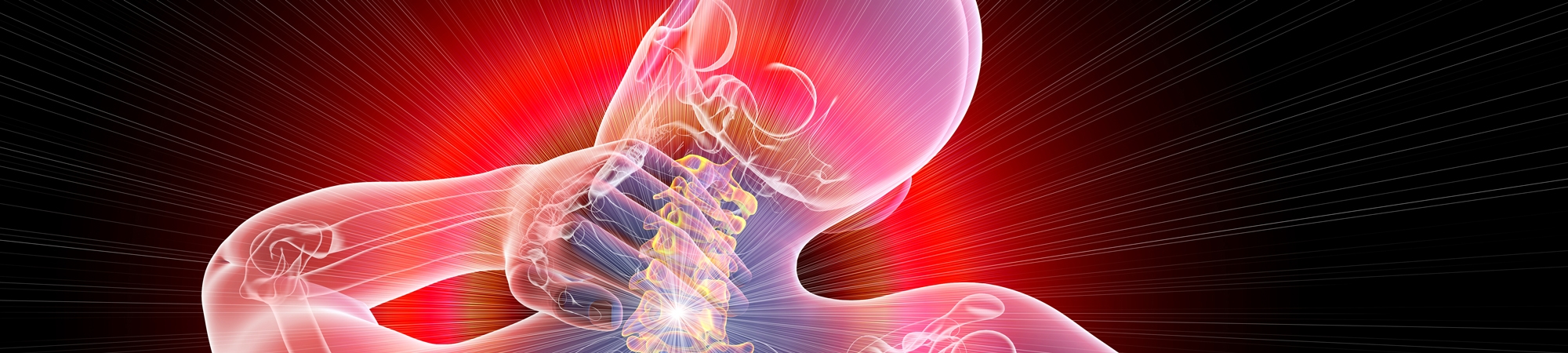 תסמונת השרירים הדואבים