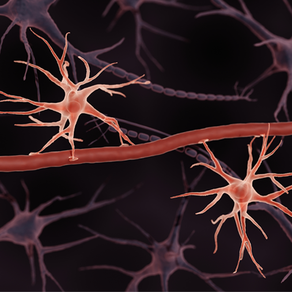 לשמור על השומר