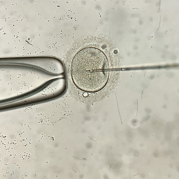 האתיקה של ההפריה החוץ גופית