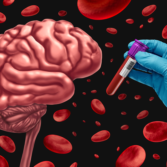 נורות אזהרה לקראת דמנציה