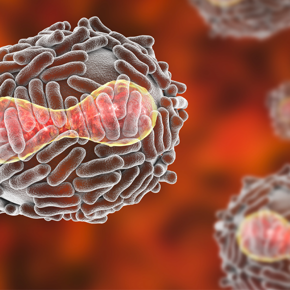 מחלות ללא גבולות: מחצבת ועד דבר