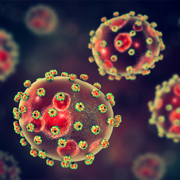 מחלות ללא גבולות: עדכוני חצבת