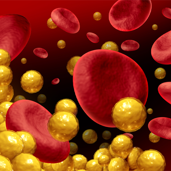 להשתיק את הכולסטרול